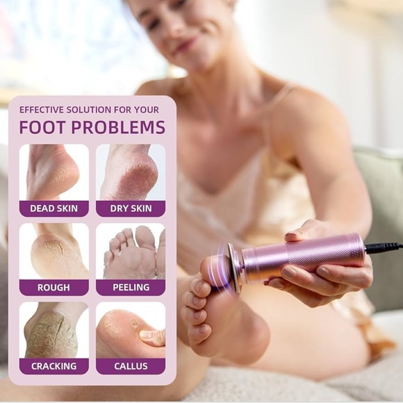 New in box - Amazon - Electric Foot File - Picture 5 of 7